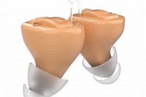 Fix Adult Muffled Hearing After Ear Tube Surgery: Causes & Tips Safem Fabrication - Precision Engineering & Custom Manufacturing Solutions Fix Adult Muffled Hearing After Ear Tube Surgery: Causes & Tips | Safem Fabrication - Precision Engineering & Custom Manufacturing Solutions