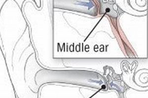 Why Your Ear Feels Full & Muffled + Easy Fixes Safem Fabrication - Precision Engineering & Custom Manufacturing Solutions Why Your Ear Feels Full & Muffled + Easy Fixes | Safem Fabrication - Precision Engineering & Custom Manufacturing Solutions