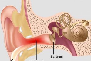 Swimmer's Ear: Why Ear is Muffled After Swimming + Tips Best Mufflers for Cars & Trucks | Performance, Sound & Durability Upgrades Swimmer's Ear: Why Ear is Muffled After Swimming + Tips | Best Mufflers for Cars & Trucks | Performance, Sound & Durability Upgrades