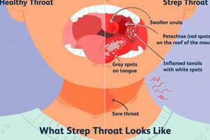 Solve Muffled Voice & Sore Throat: Causes & Relief Tips Best Mufflers for Cars & Trucks | Performance, Sound & Durability Upgrades Solve Muffled Voice & Sore Throat: Causes & Relief Tips | Best Mufflers for Cars & Trucks | Performance, Sound & Durability Upgrades