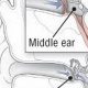 Why Right Ear Feels Muffled? Causes & Relief | Best Mufflers for Cars & Trucks | Performance, Sound & Durability Upgrades