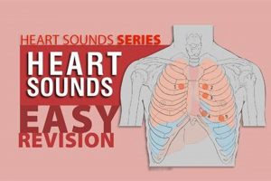 Deciphering Muffled Heart Sounds Audio: Causes & Analysis Best Mufflers for Cars & Trucks | Performance, Sound & Durability Upgrades Deciphering Muffled Heart Sounds Audio: Causes & Analysis | Best Mufflers for Cars & Trucks | Performance, Sound & Durability Upgrades