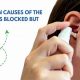 Why Ear Feels Muffled (But No Wax)? Causes & Relief | Best Mufflers for Cars & Trucks | Performance, Sound & Durability Upgrades