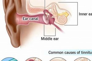 Help! My Muffled Ear with Ringing: Causes & Relief | Best Mufflers for Cars & Trucks | Performance, Sound & Durability Upgrades
