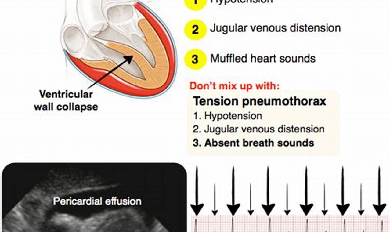 Understanding Muffled Heart Sounds: Causes & Risks Best Mufflers for Cars & Trucks | Performance, Sound & Durability Upgrades Understanding Muffled Heart Sounds: Causes & Risks | Best Mufflers for Cars & Trucks | Performance, Sound & Durability Upgrades