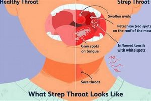 Relieve a Sore Throat Muffled Voice: Causes &amp; Remedies | Best Mufflers for Cars & Trucks | Performance, Sound & Durability Upgrades